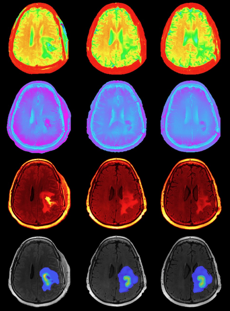 brain image